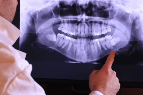Best Weekend Emergency Dentist in Lake Of The Woods, IL