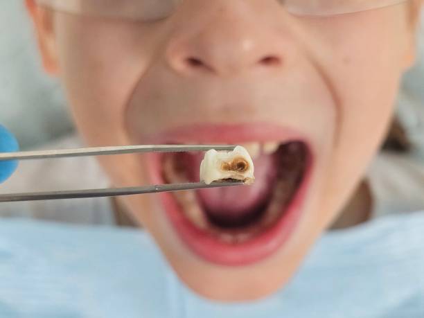 Best Emergency Gum Treatment in Lake Of The Woods, IL