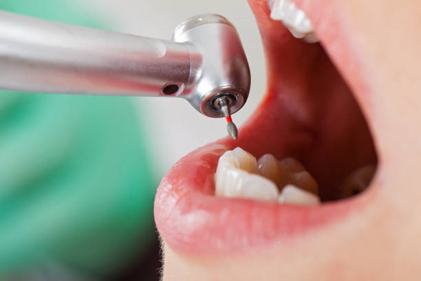 Best After-Hours Dental Trauma Care in Lake Of The Woods, IL